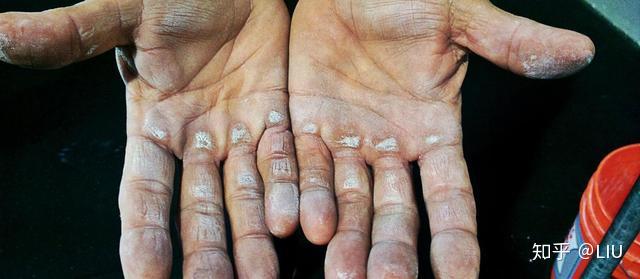 健身手套是否需要_健身护具使用心得_健身手套紧点好吗