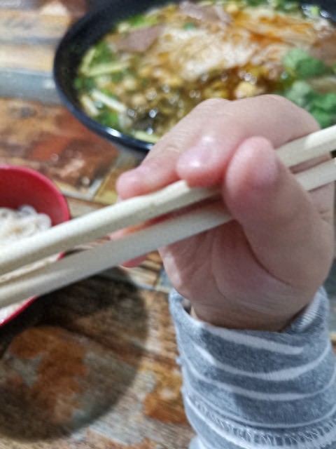 新门内部资料免费查询 男童拿筷子摔倒五厘米断筷